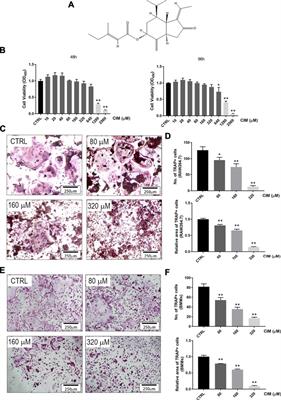 Cimifugin Suppresses NF-κB Signaling to Prevent Osteoclastogenesis and Periprosthetic Osteolysis